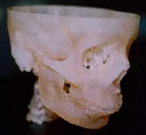 Fabbed model of human skull